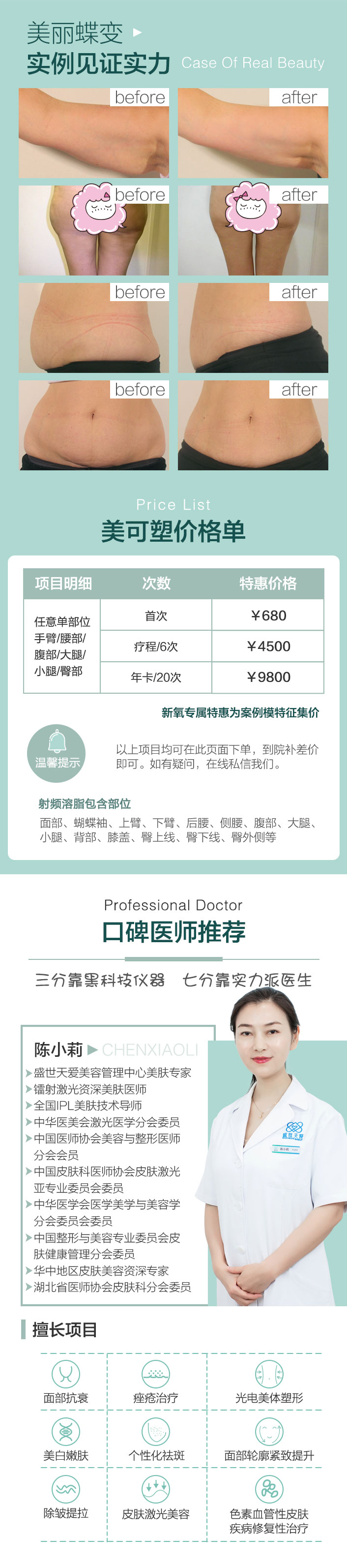 美可塑_03.jpg